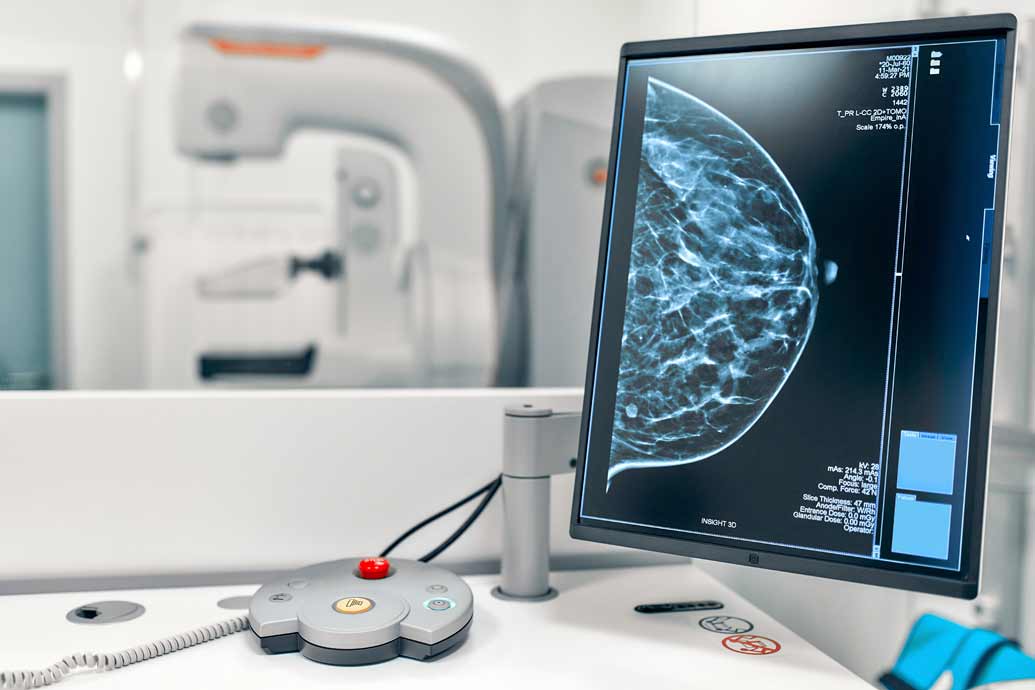 mammografia centro mammografico