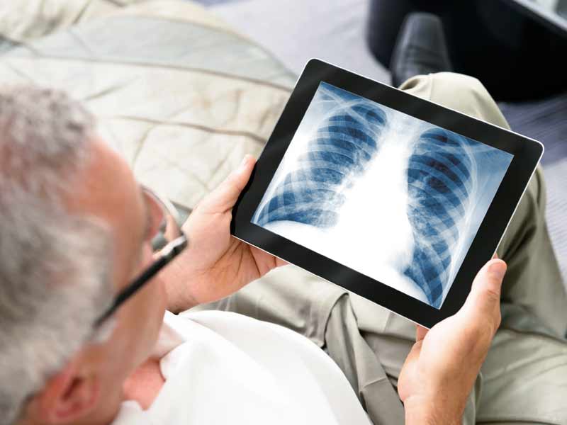 Radiografie di alta qualità – Lastre in alta risoluzione